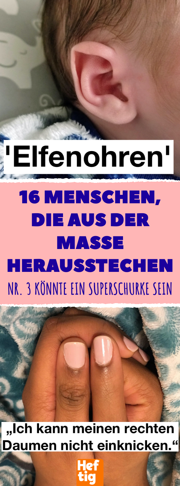 9 Menschen mit außergewöhnlichen Körperteilen