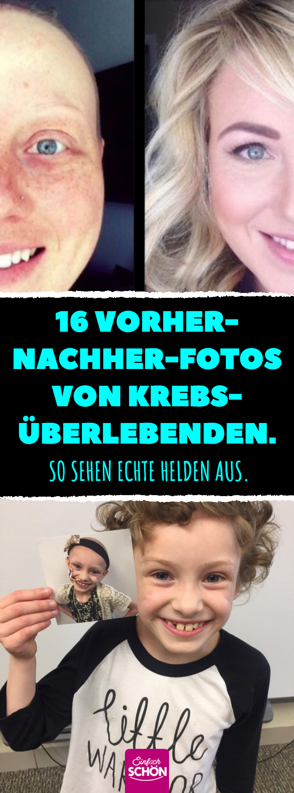 16 Vorher-nachher-Fotos von Krebsüberlebenden.