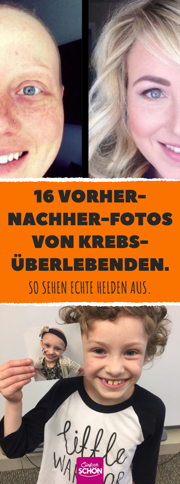 16 Vorher-nachher-Fotos von Krebsüberlebenden.