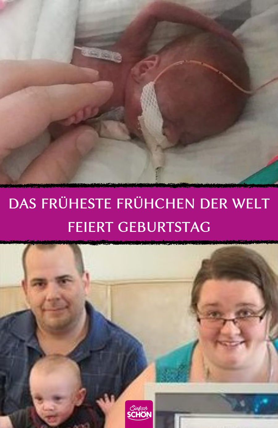 Das am frühesten geborene Baby der Welt feiert 1. Geburtstag