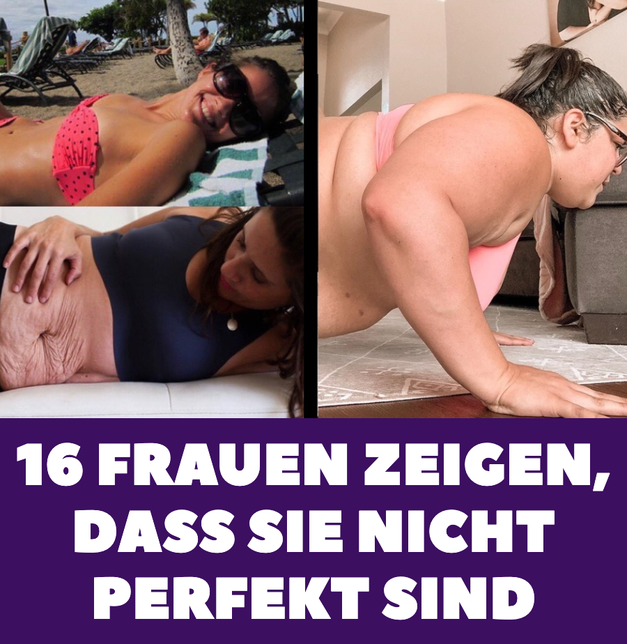 Nicht perfekt: Diese Frauen sind stolz auf ihren Körper