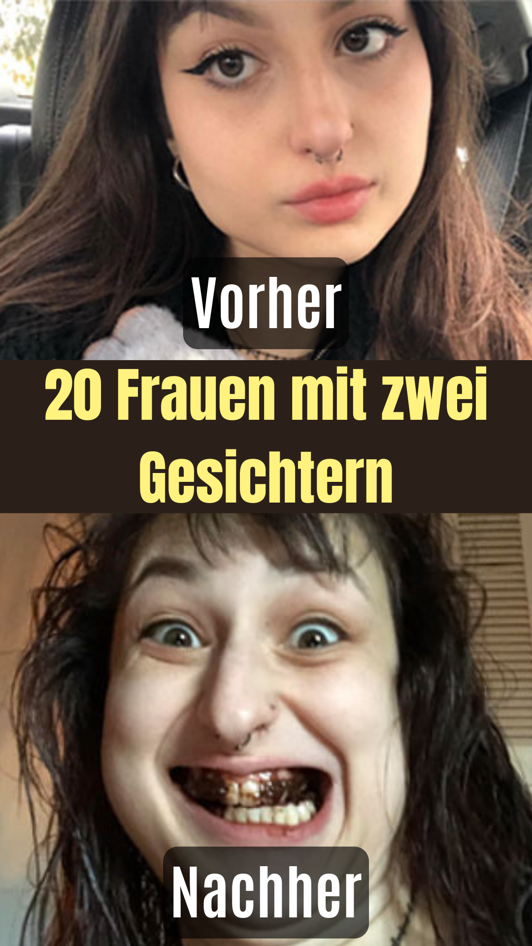 Vorher-nachher-Bilder: Frauen zeigen schönste Grimassen